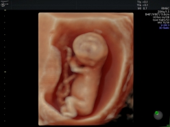 Hello Baby♪4D